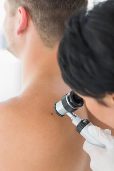 Médica Examinando Melanoma Com Dermoscópio Parte Trás Homem — Fotografia de Stock