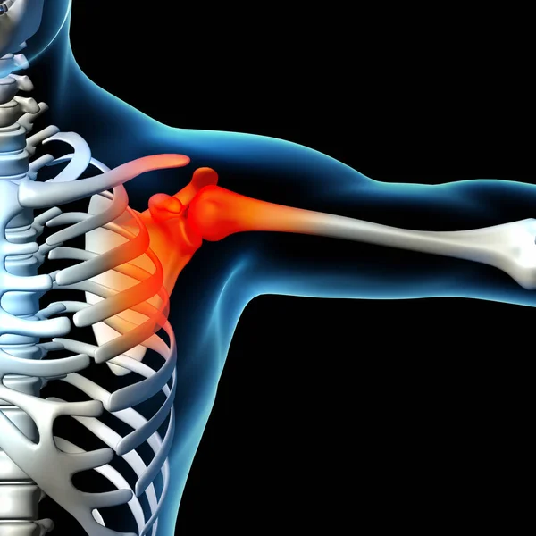 与骨架的肩关节解剖人体肩痛 — 图库照片