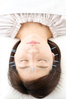 Bir kadının akupunktur kliniğinde yüzüne akupunktur yaptırması...