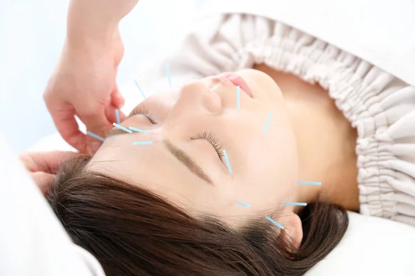 Up of a woman getting acupuncture on her face at an acupuncture clinic