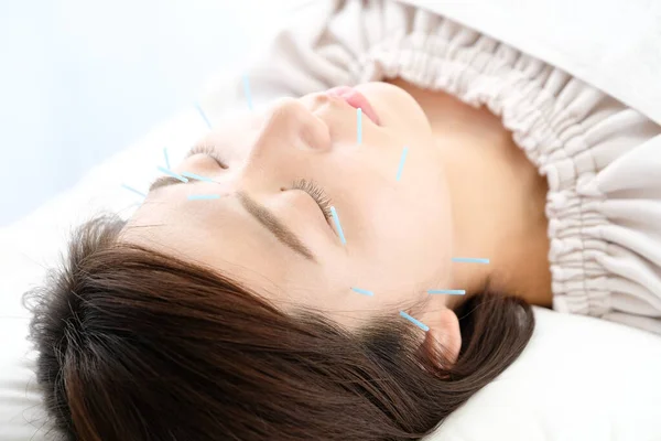 Up of a woman getting acupuncture on her face at an acupuncture clinic