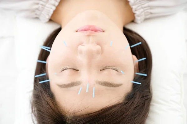 Up of a woman getting acupuncture on her face at an acupuncture clinic