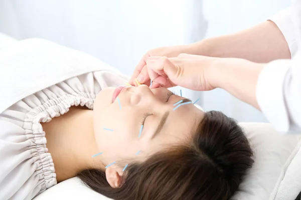 Yüzü Akupunkturlu Kadın Pratisyenlerin Elleri — Stok fotoğraf