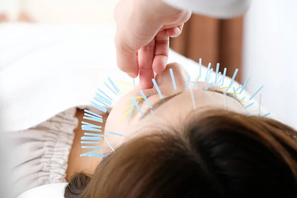 Manos Mujeres Practicantes Cuyo Rostro Está Acupuntado — Foto de Stock