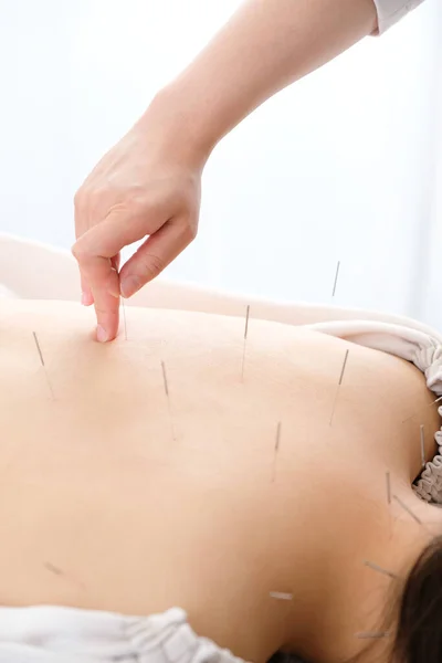 Kobieta Igłą Wbitą Plecy Jasnej Klinice Akupunktury — Zdjęcie stockowe