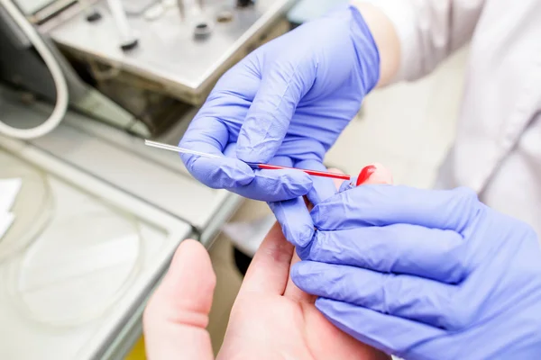 Läkaren Tar Patientens Blodprov Från Ett Finger Mot Bakgrund Mätutrustningen — Stockfoto