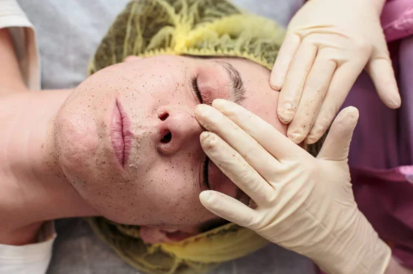 Kosmetolog Czyści Skórę Twarzy Pacjenta Pomocą Peelingu Biurze Zbliżenie — Zdjęcie stockowe