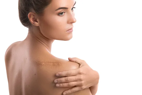 Woman Scar Her Shoulder White Background — Stock Photo, Image