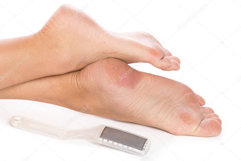 Female feet and callus remover tool on white background