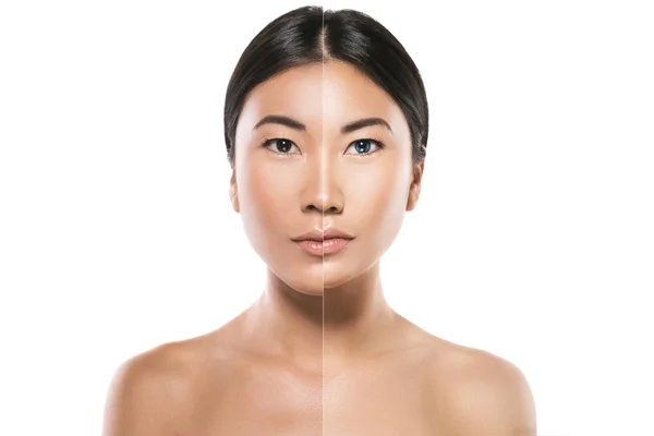 Transformation Asian Woman Result Plastic Surgery Retouch — Stock Photo, Image