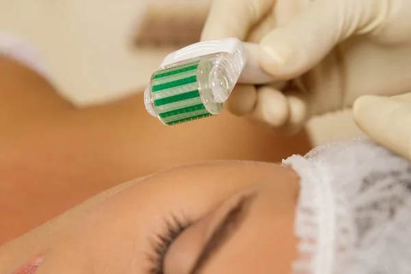 Mujer Salón Belleza Durante Procedimiento Mesoterapia Tratamiento Microneedling Facial Con —  Fotos de Stock