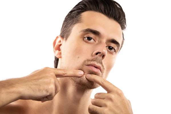 젊은 남자 이다 압박 여드름 에 그의 턱 — 스톡 사진