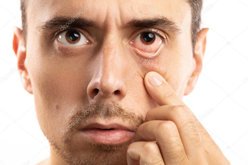 Man checking condition of his eye