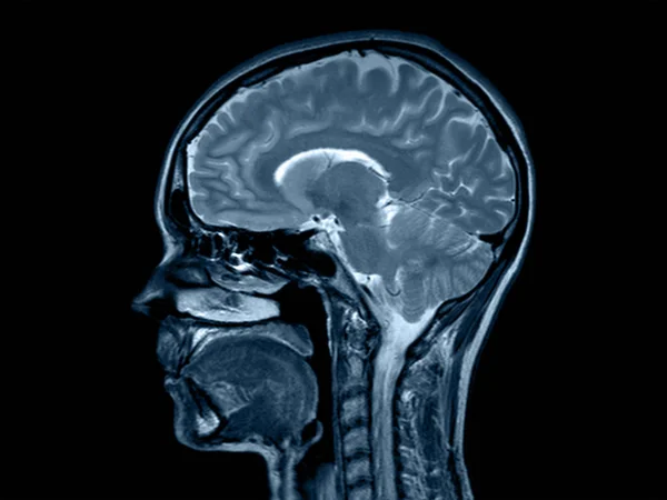 beyin x-ray ct kafa vertebra omurga kordon kesi