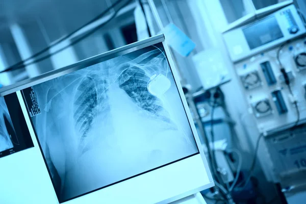 Röntgenfilm Auf Der Leuchttafel Ausgestatteten Medizinischen Raum — Stockfoto