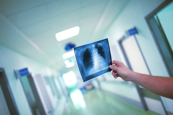 Médico Varón Mirando Imagen Roentgen Del Tórax Del Paciente Pasillo — Foto de Stock