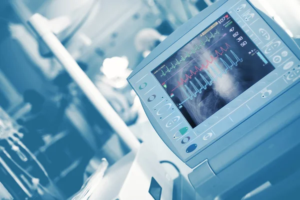 Ekg Vågor Och Röntgen Bild Bröstet Life Support Monitorn Läkare — Stockfoto