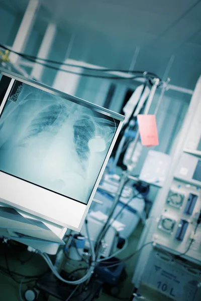 急诊室与病人在床周围的技术设备和胸部 线图像 — 图库照片