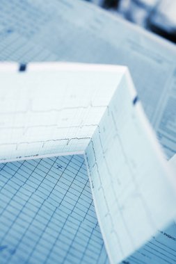 EKG ve hemşirelik İstasyonu tablo başka bir tıbbi kayıtları.