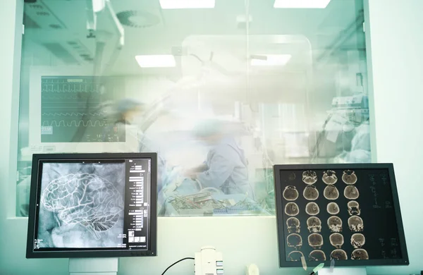 Concepto Explorar Las Posibilidades Del Cerebro Durante Exploración Por Rayos — Foto de Stock