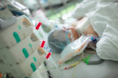 Kritik hasta hasta yoğun bakımda yuvarlak saat gözlem altında.