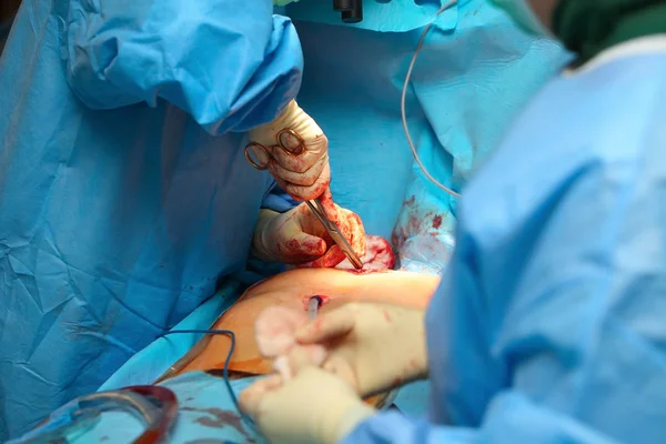 Cirujano Durante Operación Paciente — Foto de Stock