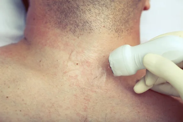 Ultraschalluntersuchung Des Halses Eines Männlichen Patienten — Stockfoto
