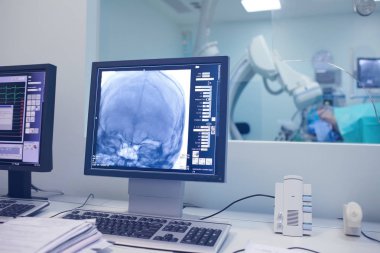 Cerrahi işlem sırasında monitörde hasta kafatasının X-Ray tarama.