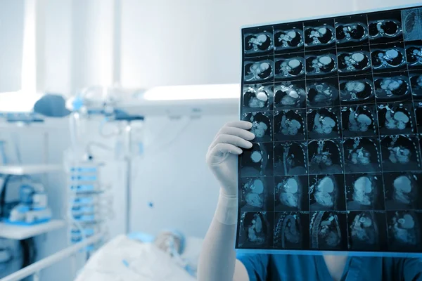 Médica Feminina Olha Para Imagem Varredura Dos Órgãos Torácicos Paciente — Fotografia de Stock