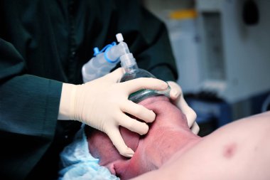 Anestezist doktor hasta ile iş yerinde. Anesthesi indüksiyon sırasında yüz maskesi ile nefes anestezik gaz