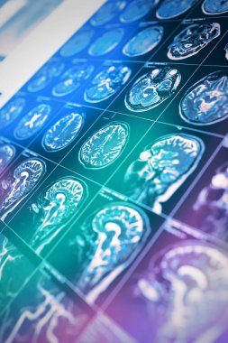 MRI tarama renkli ışık, bilimsel ve pratik çalışmaları, Haberler, web sayfası için arka plan ışınlarının hastanın baş