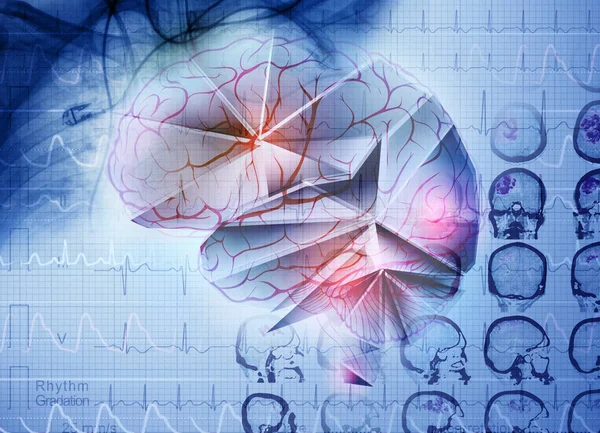 Концепция Мозга Научном Медицинском Свете Вымышленное Изображение Человеческого Мозга Артериями — стоковое фото