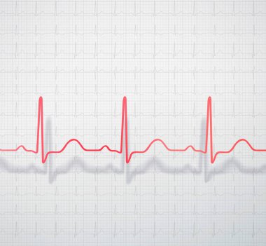 Tıbbi EKG Kağıt arka plan üzerinde dağınık şekilde yer alan kardiyogram