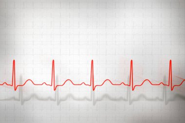 Gri arka plan üzerinde soyut kardiyogram kompleksleri