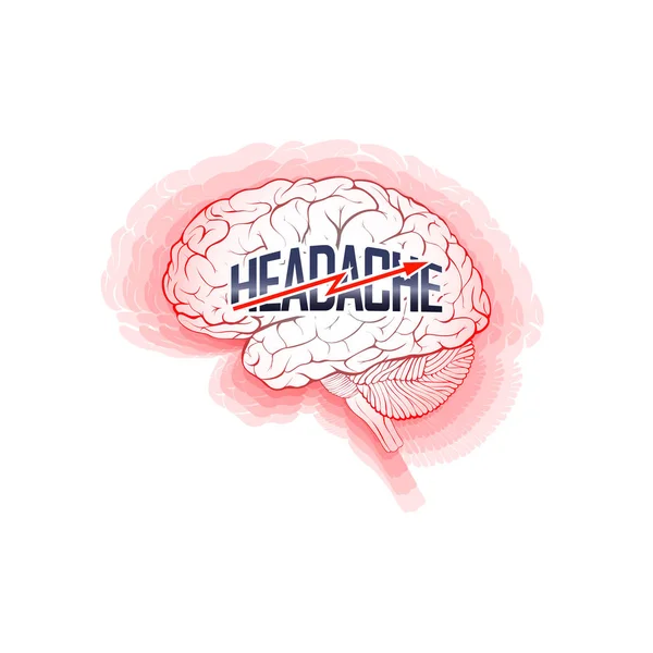 Headache Concept Depicting Inflamed Brain Disease Illustration Isolated White Backgroun — Stock Photo, Image