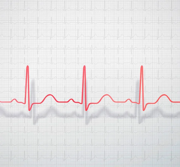 Cardiogramma Posizionato Spazialmente Sullo Sfondo Della Carta Ecg Medica — Foto Stock