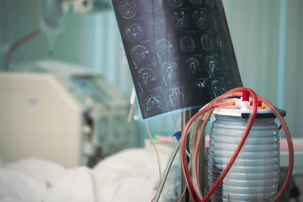 MRI image next to the patient bed surrounded by advanced equipment — Stock Photo, Image