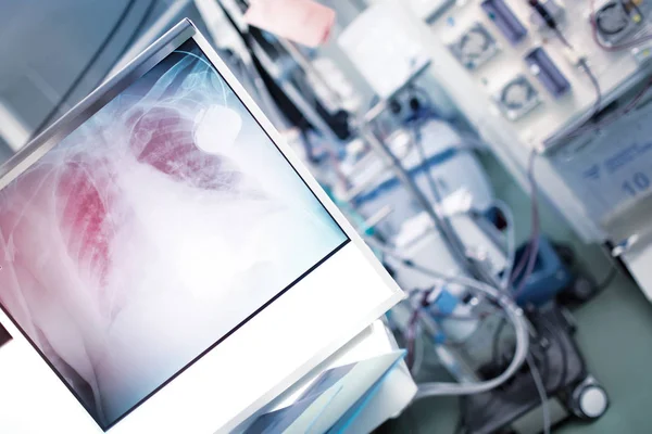Radiografía de los pulmones en el fondo de la habitación de hospital equipada avanzada — Foto de Stock