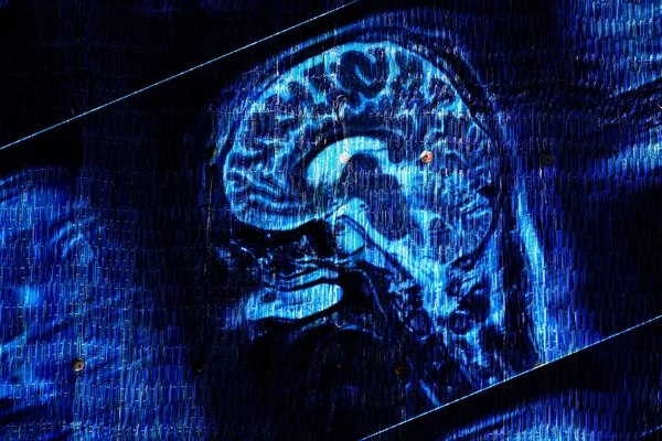 Onderdeel van een MRI-scan van een menselijk hoofd als medische achtergrond — Stockfoto