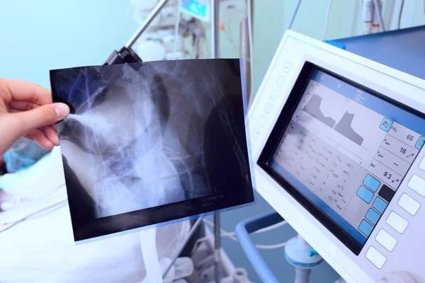 Medizinischer Monitor und das Röntgenbild in der Hand des Arztes auf der Station — Stockfoto