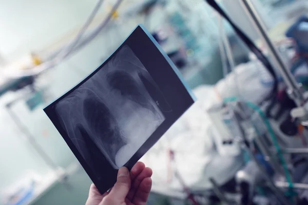Lekarz posiada zwykły radiograf klatki piersiowej pacjenta w er — Zdjęcie stockowe
