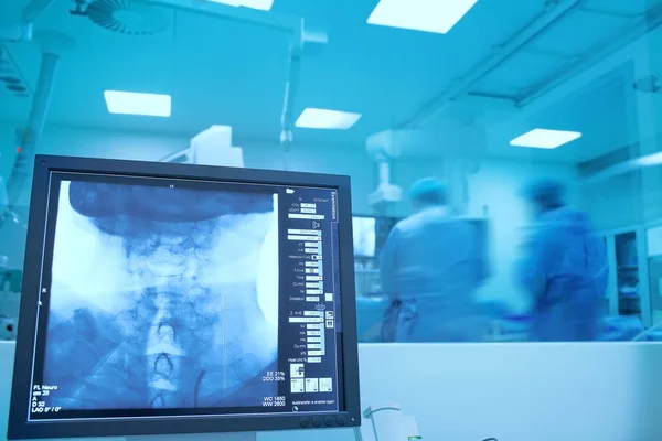 엑스레이 모니토와 신경 외과 중 두 의사 — 스톡 사진