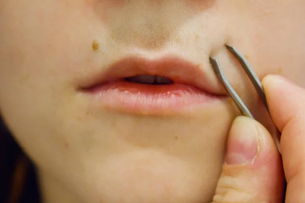 girl removes hair over her upper lip, female mustache with sharp tweezers at home. beauty treatments, hair removal.