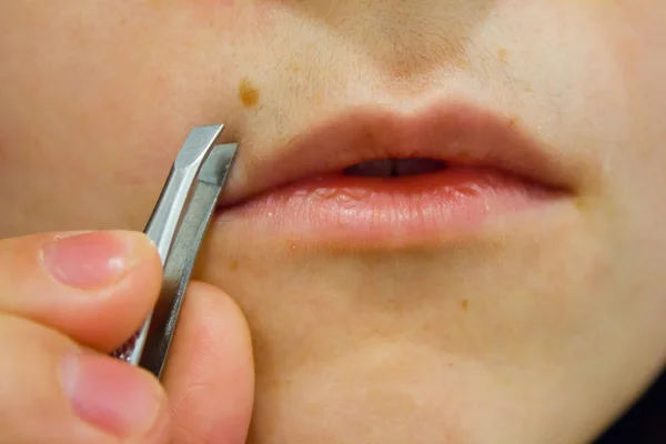 girl removes hair over her upper lip, female mustache with sharp tweezers at home. beauty treatments, hair removal.