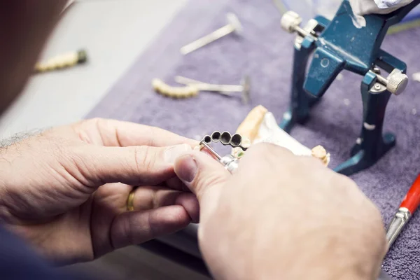 Zahntechniker arbeitet an einer metallischen Prothese — Stockfoto