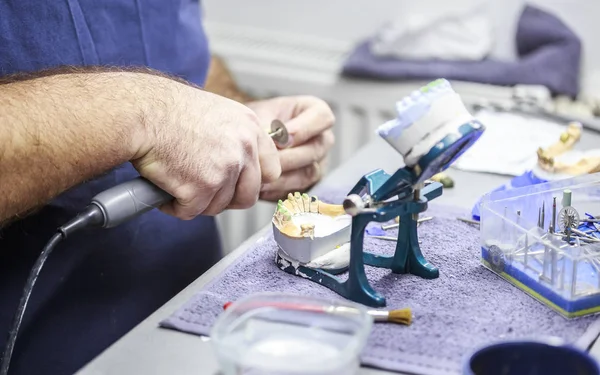 Οδοντιατρικός τεχνικός που εργάζεται με αρθρογράφο στο οδοντιατρικό εργαστήριο — Φωτογραφία Αρχείου
