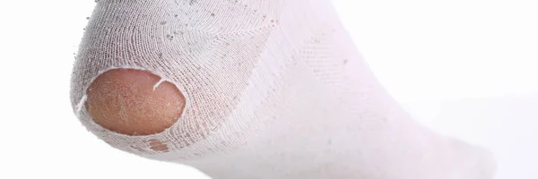 Ripped white sock on male leg isolated — Stock Photo, Image