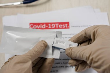 Laboratuvar bilimcisi viral proteinlerin varlığını tespit etmek için antikor testi (rdt) yapar. Koronavirüs hastalığı COVID-19, PCR laboratuvar testi. Test girdileri