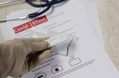 Laboratuvar bilimcisi viral proteinlerin varlığını tespit etmek için antikor testi (rdt) yapar. Koronavirüs hastalığı COVID-19, PCR laboratuvar testi. Test girdileri