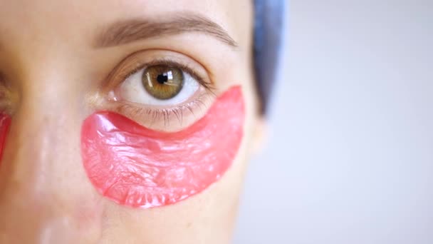 Young woman used pink collagen hydrogel cosmetic eye patches under eyes. Lifting of wrinkles. Skin care at home. Cosmetology procedure — Stock Video